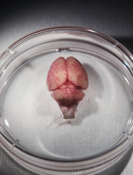 科学家耗资1亿美元重建大鼠大脑一小块 为何那么难